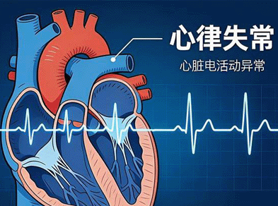 运动要有规律、有度，防止过量运动导致猝死，控制运动频率和强度，别跟身体对着干。